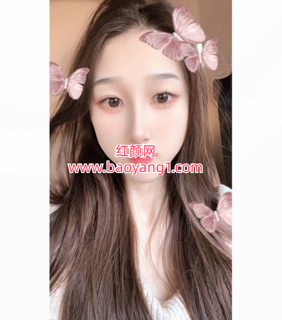 QQ20250314-100706.png